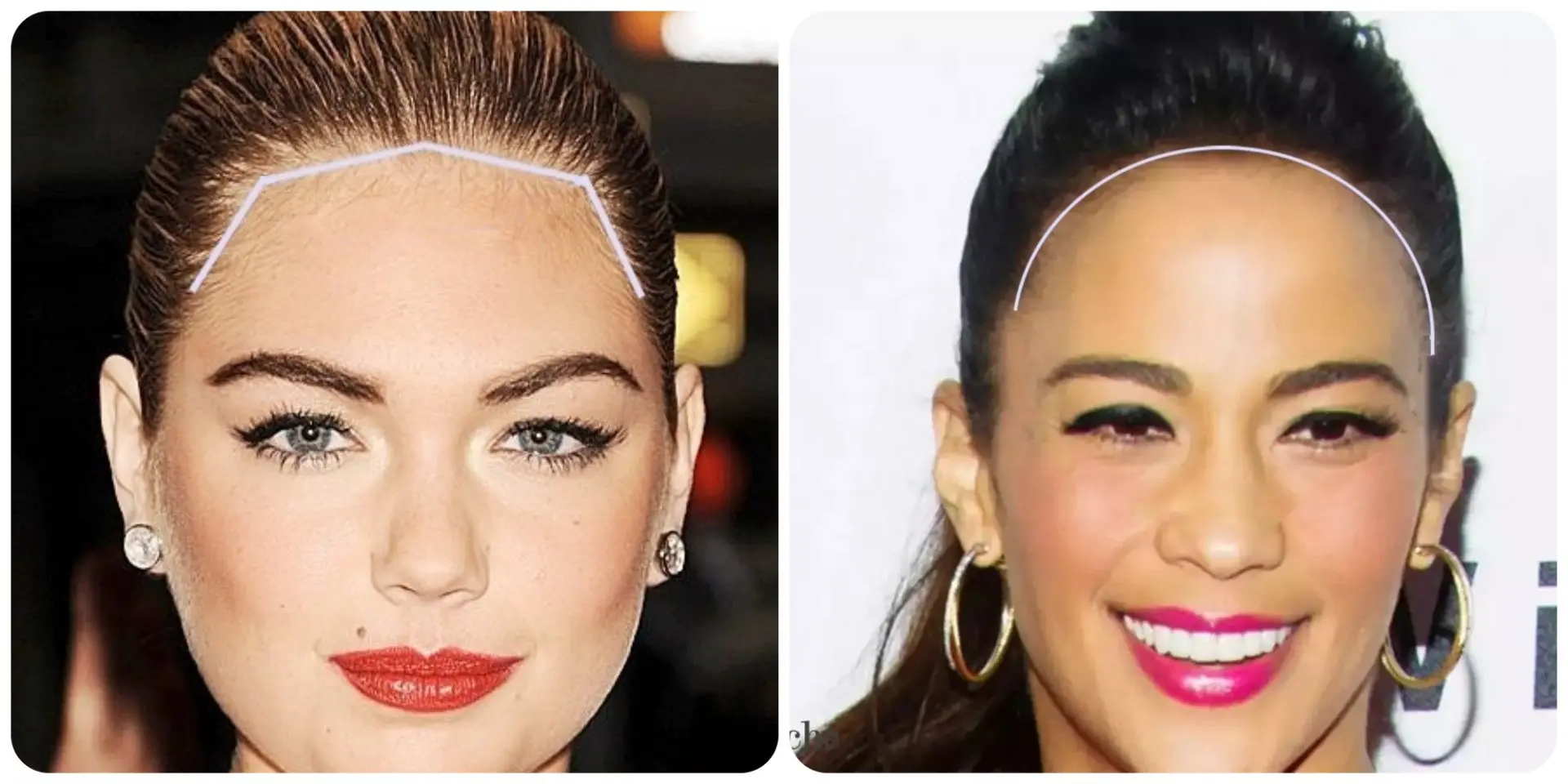 Typical female hairlines