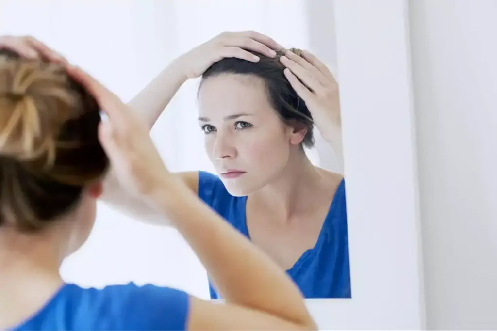 Woman parting her hair to reveal widening thinning at the crown