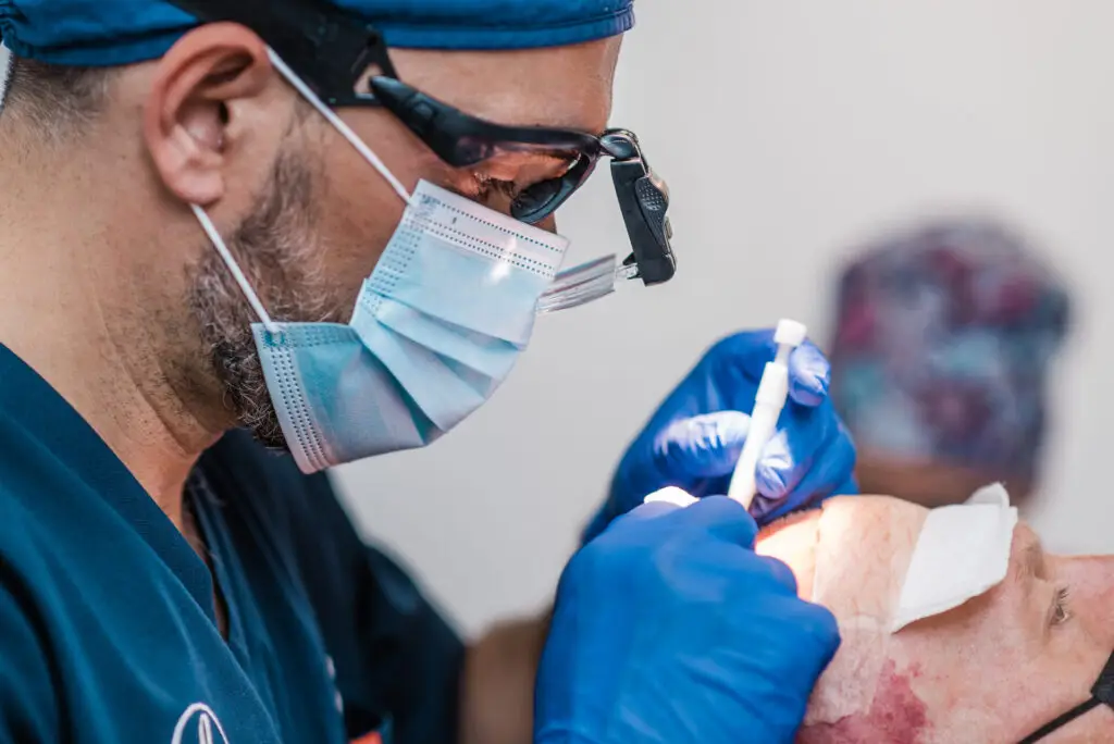 Dr Bonaros wearing surgical loupes during an FUE hair transplant