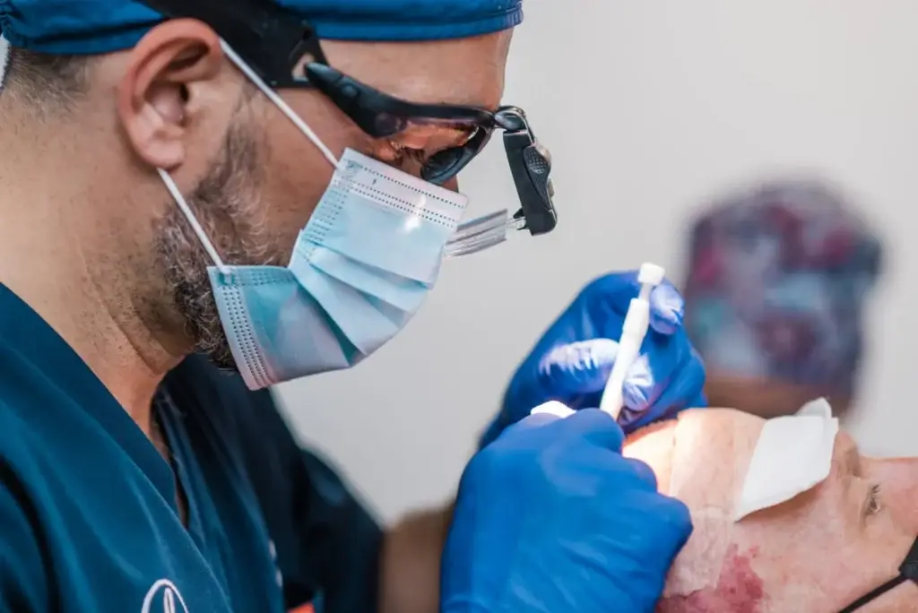 Dr Bonaros implanting grafts during an FUE hair transplant procedure