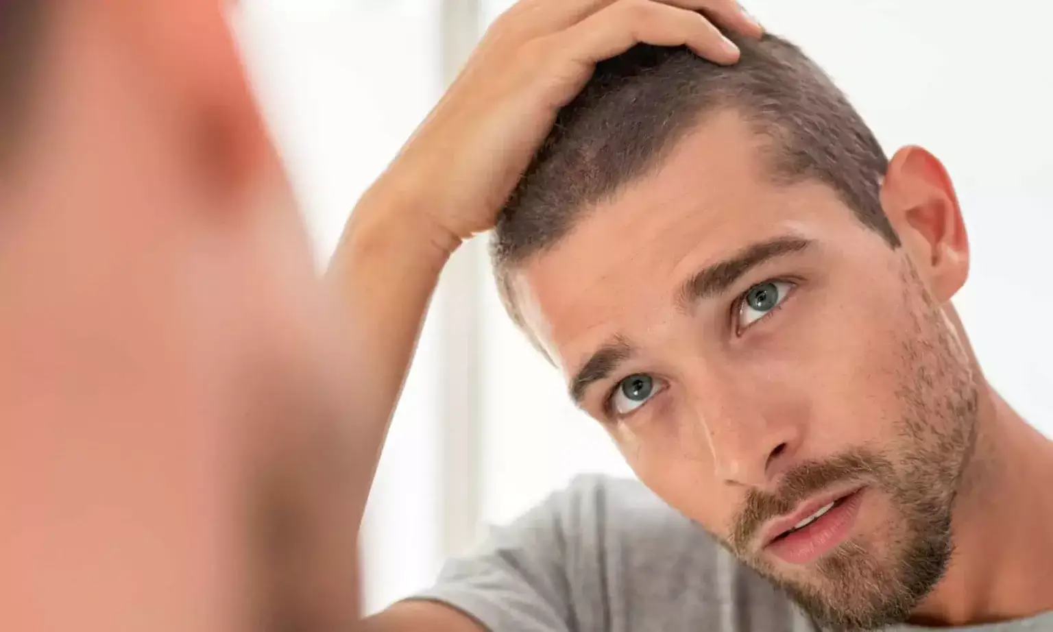 Man sitting with his head in his hands, illustrating the emotional impact of hair loss