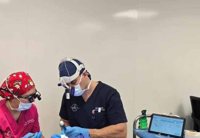 FUE Surgery performed by DR Boonaros